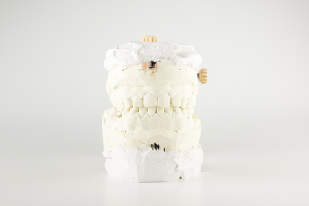 Occludator with grafted in it models of dentitionの写真素材