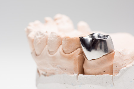 Steel artificial dental crown for dentition restorationの写真素材