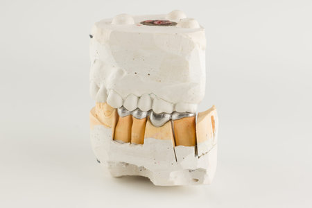 bases of metal-cast bridges on an artificial dental model