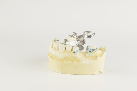 steel base of the clasp prosthesis on the gypsum model