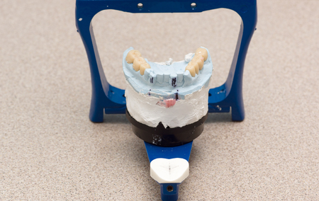 dental articulator with plastered dental bridge modelsの写真素材