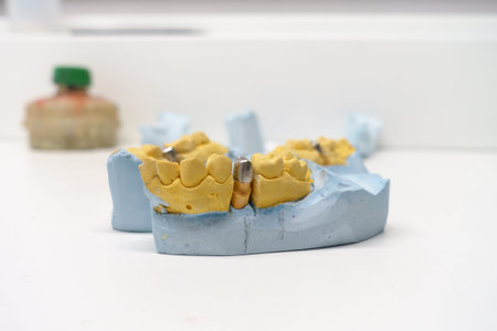 dentist examines artificial dental crowns on a model in his office