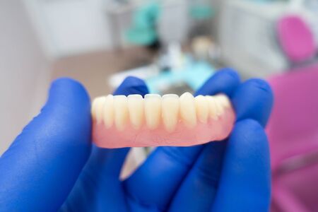removable denture in the hands of a doctor in blue glovesの写真素材