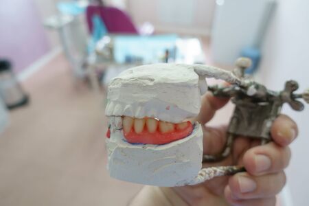 removable denture in the hands of a doctor in a dental officeの写真素材