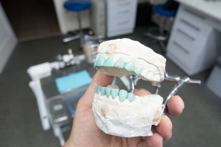modeling of artificial teeth on a plaster model for visual displayの写真素材