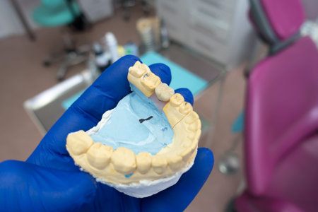 close-up ceramic tooth crown on a plaster model of teeth in the dentist's hand. work of a dental...