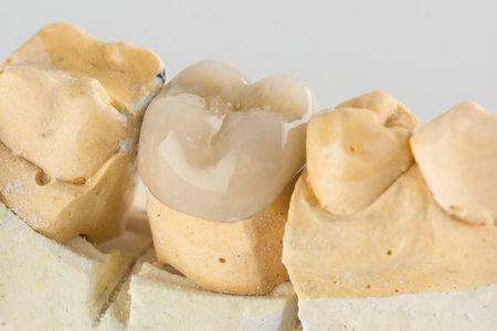 metal ceramic dental crown photographed close-up on a white background