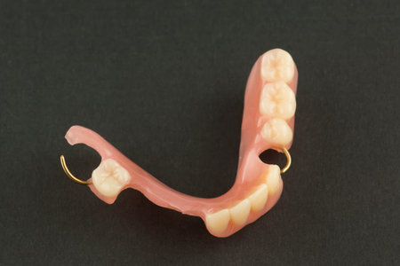 acrylic dental prosthesis with metal retaining elements on black background
