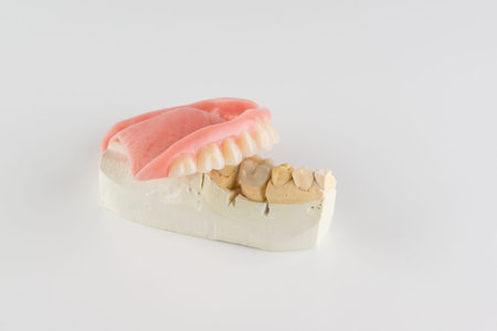 large image of a modern denture nylone on a white background