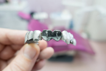metal dental bridge in the manufacturing process