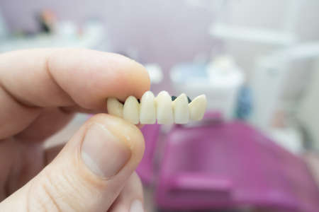 dental ceramic metal bridges in the hands of a doctorの写真素材
