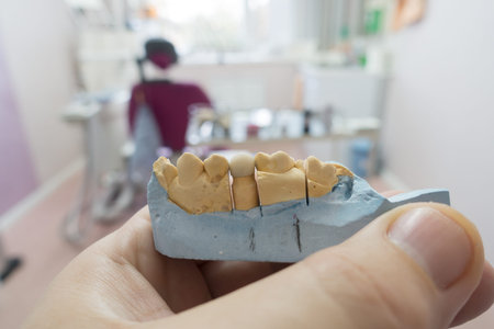 modern nylon dental prosthesis in the hands of a doctor