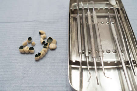 dental ceramic metal bridges are on the tableの写真素材