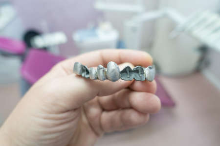 metal dental bridge in the manufacturing processの写真素材