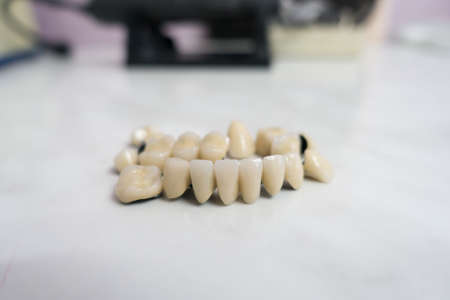 dental ceramic metal bridges are on the tableの写真素材