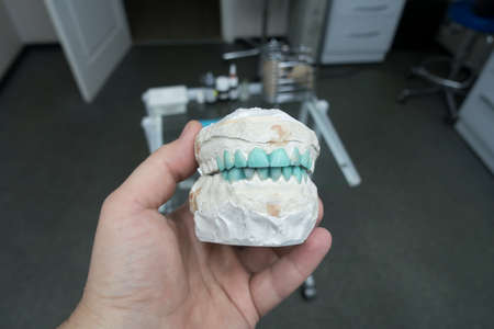modeling of artificial teeth on a plaster model for visual displayの写真素材