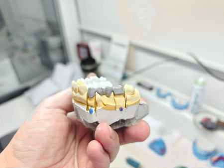 The doctor demonstrates a steel frame from a metal-ceramic dental bridge