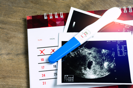 Pregnancy test which results is pregnant and ultrasound film show results is mild baby womb on calendar and woodle table background.の写真素材