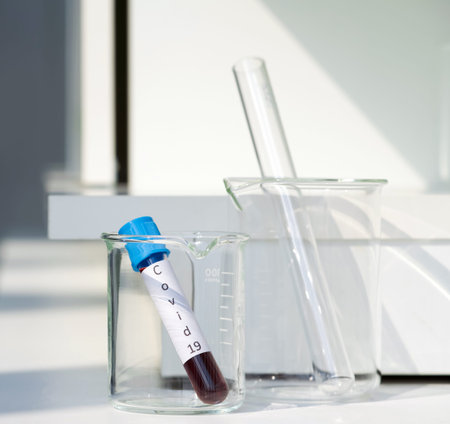 Blood collection tube from covid-19 patient on a white laboratory table.