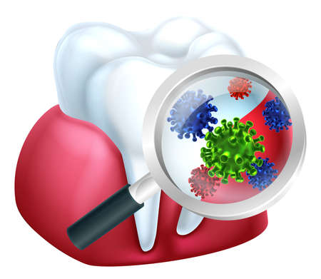 A medical dental illustration of bacteria on a tooth and gum being magnifiedのイラスト素材