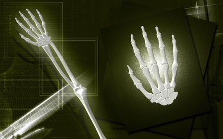 Digital illustration of hand bone in colour background 	の写真素材