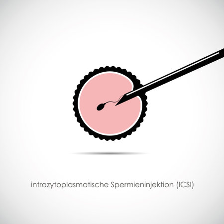 fertility reproduction of ovum and spermatozoon ICSI vector illustration EPS10のイラスト素材