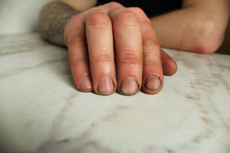 Left male hand with cuts and dirt close-up.の写真素材