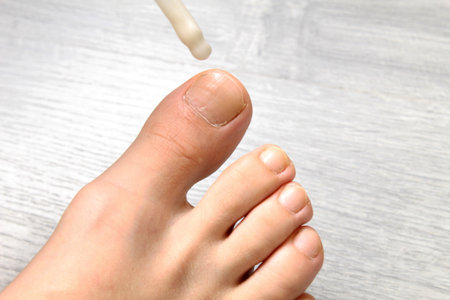 Treatment of fungal diseases of the legs. Applying medicine, ointment to the nails.の写真素材