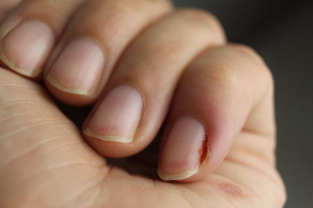 A close-up of a womans left hand. Hand careのeditorial素材