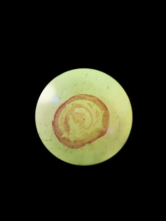 Cross section of an earthworm. The internal structure of an earthworm in a microscope