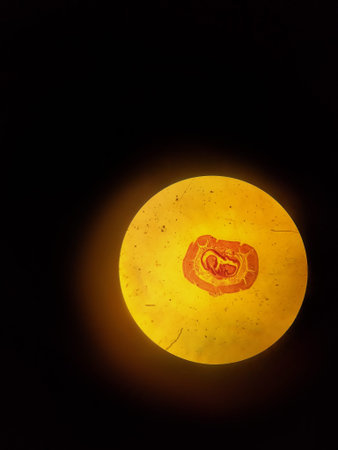 Cross section of an earthworm. The internal structure of an earthworm in a microscopeの写真素材
