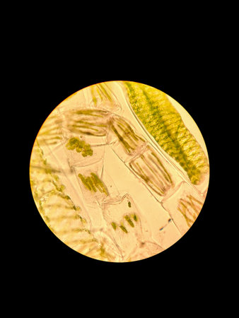 Dirty water sample under a microscope. Algae zignema and spirogyra