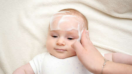 Cute little baby boy suffering from dermatitis being cured with medical ointment and suds. Concept of newborn baby hygiene, health and skin care.の写真素材