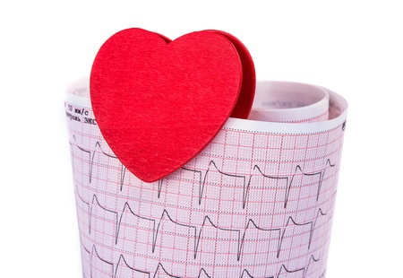 electrocardiogram with a heart on a white background