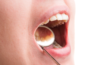 dental treatment at the dentist