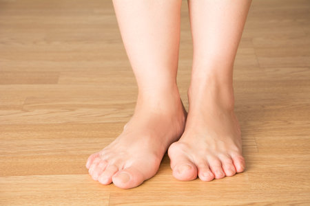 Hallux valgus, bunion in foot, pain in legs, on a wooden backgroundの写真素材