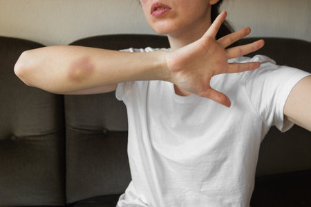 Young woman in white t-shirt with large bruise on arm. Say stop to domestic violence.の写真素材