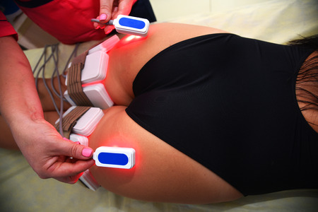 lipo laser. Hardware cosmetology. Body care. Non surgical body sculpting. body contouring,...