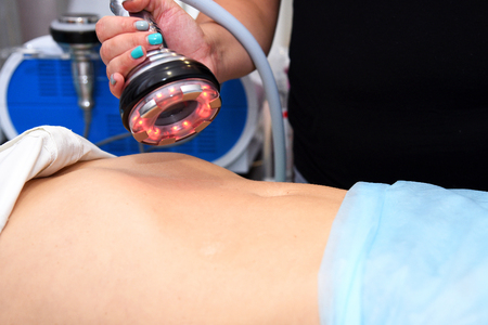 Rf skin tightening. Vacuum massage. Hardware cosmetology. Body care. Non surgical body sculpting. anti-cellulite and anti-fat therapy in beauty salonの写真素材