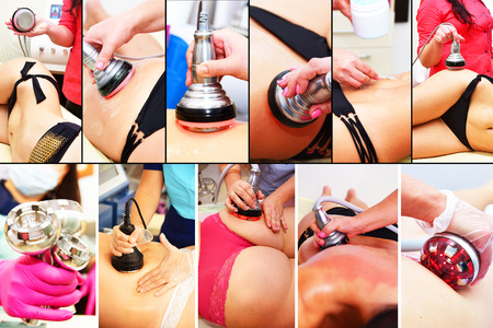 Rf skin tightening, belly. Hardware cosmetology. Ultrasound cavitation body contouring treatment, anti-cellulite and anti-fat therapy in beauty salon. Large collage with different parts of the bodyの写真素材