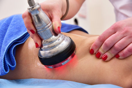 Rf skin tightening. Vacuum massage. Hardware cosmetology. Body care. Non surgical body sculpting....