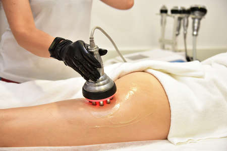 Rf skin tightening. Hardware cosmetology. Ultrasound cavitation body contouring treatment,...