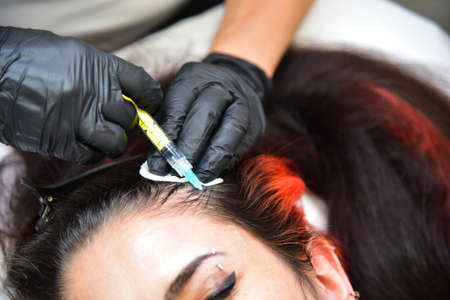 Treatment of baldness with beauty injections. Cosmetologist hands in gloves make a subcutaneous...