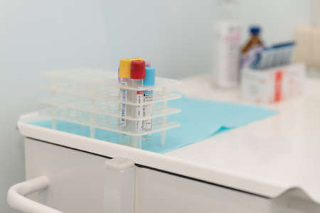 Kiev, Ukraine - June 12, 2019: Urine sample bottle red urine and normal urine.