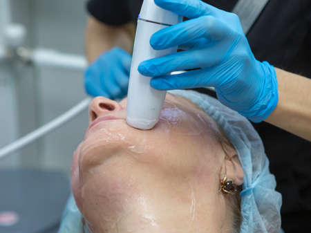 Non-surgical face lifting. SMAS lifting ultrasonic. The process of rejuvenation. Hardware...