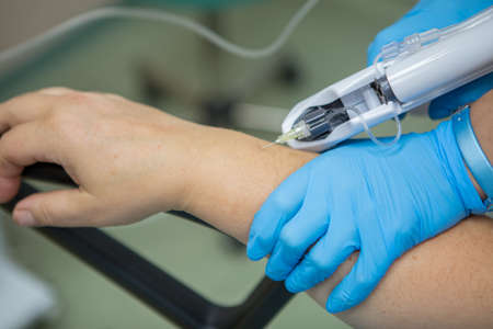 The doctor injects carbon dioxide using a needle machine into the skin of the patient's hand. Carboxytherapy. Treatment and rejuvenation of the skin of the hands. Tunnel syndrome, dry skin of the hands. High quality photoの写真素材