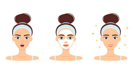 Young woman with acne. Treatment, before and after skincare. Face mask, beauty concept, vector illustrationのイラスト素材