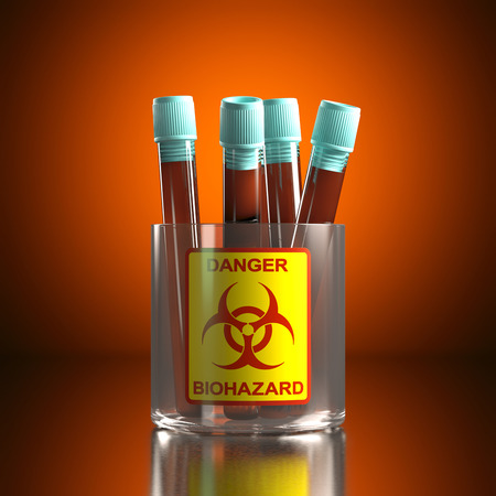 Test tube with contaminated blood. Clipping path included.の写真素材