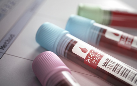 Tubes with blood for testing scientific and medical. Depth of field with focus on the Blood Test label.の写真素材