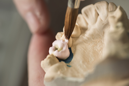 Dental prosthesis, artificial tooth, prosthetic, hands working on the denture, false teeth.の写真素材